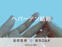 「へバーデン結節」の初期症状・発症時にやってはいけないことはご存知ですか？