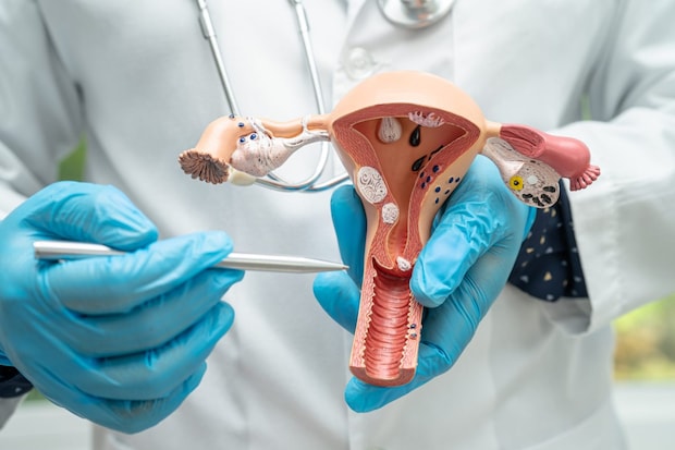 子宮筋腫で手術を行う基準