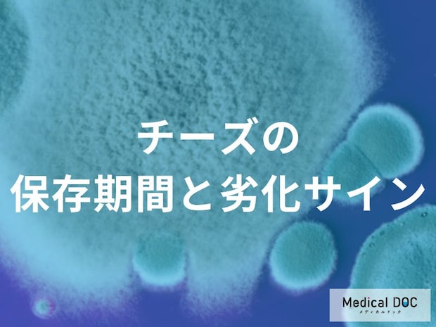 チーズに生えた“あの色のカビ”は要注意?食べてはいけない劣化のサイン