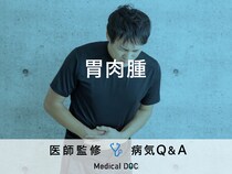 「胃肉腫」を発症すると現れる症状・原因・「胃がん」との違いはご存知ですか？