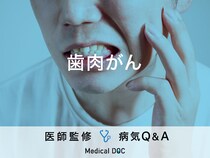 「歯肉がん」を発症すると現れる症状・見分けはご存知ですか？医師が監修！