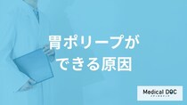 「胃ポリープができる原因」はご存知ですか？医師が解説！