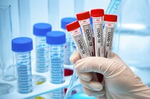 【新型コロナウイルス】インフルエンザと同等の「5類」へ見直し 厚生労働省が本格検討