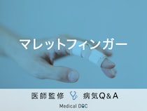「マレットフィンガー」の痛みの特徴・治療期間はご存知ですか？【医師監修】
