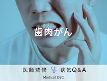 「歯肉がん」を発症すると現れる症状・見分けはご存知ですか？医師が監修！