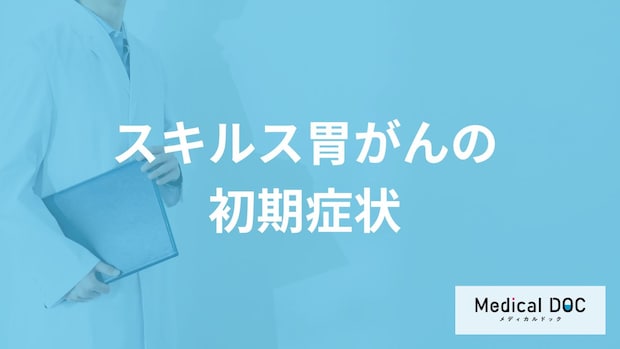 「スキルス胃がんの3つの初期症状」はご存知ですか?【医師解説】