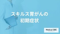 「スキルス胃がんの3つの初期症状」はご存知ですか？【医師解説】