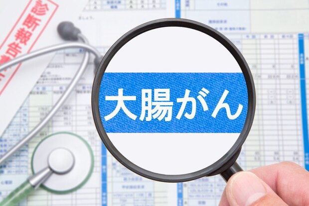 大腸がんとはどんな病気？