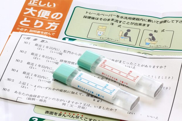 大腸がんの検査と診断、治療について教えて！