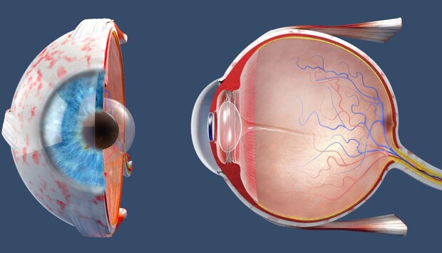 【閉塞隅角緑内障の治療】基本編