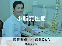 「小脳変性症」の初期症状・余命はご存知ですか？医師が監修！