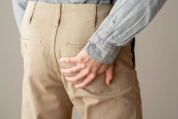 痔ってどんな疾患？ 医師が解説