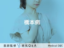 「橋本病」とは？症状・原因・治療法についても解説！医師が監修！