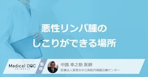 「悪性リンパ腫のしこりができる場所」はご存知ですか？【医師監修】