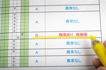 尿検査で蛋白尿と言われたらどうしたらいい？ なんの病気なのでしょうか？