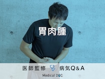 「胃肉腫」を発症すると現れる症状・原因・「胃がん」との違いはご存知ですか？