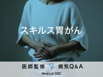 「スキルス胃がん」になると現れる症状・原因・胃がんとの違いはご存知ですか？