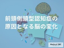 脳にどんな変化があると「前頭側頭型認知症」を発症する？【医師監修】