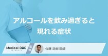 「アルコールを飲み過ぎると現れる症状」はご存知ですか？【医師解説】