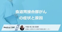 熱いもので胸に違和感は「食道胃接合部がん」のサイン？ なりやすい人を医師が解説！