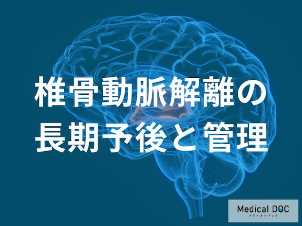 椎骨動脈解離の再発サインは？ 治療後にチェックすべき体調の変化とは【医師監修】