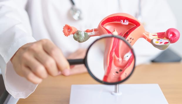 子宮内膜症の治療法