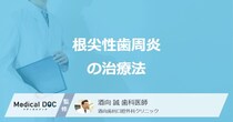 「根尖性歯周炎」は抜歯が必要？ 手術になる“3つの進行度”と治療法を解説！