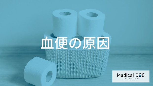 「血便」セルフチェック。色・痛み・違和感が教えてくれる内臓のSOSとは