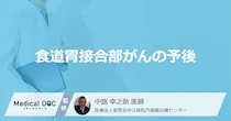 「食道胃接合部がん」はリンパ節に転移しやすい？ 生存率を医師が解説！