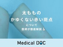 「太ももにかゆくない赤い斑点」ができる原因はご存知ですか？医師が徹底解説！