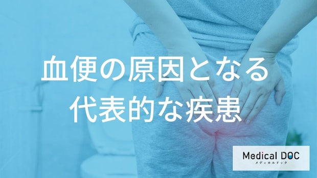 【必見】血便の原因疾患まとめ。腹痛や発熱を伴う「危険な血便」と良性疾患の違い