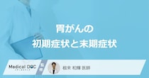 「胃がんの初期症状と末期症状」はご存知ですか？医師が徹底解説！