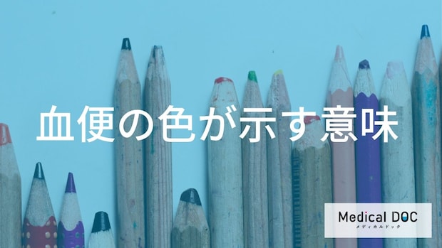 【必見】血便の色まとめ。「赤い便」と「黒い便」の緊急度と危険なサイン