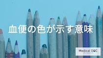 【必見】血便の色まとめ。「赤い便」と「黒い便」の緊急度と危険なサイン