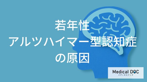 症状が出る10年前から脳内で「何」が始まっている?若年性アルツハイマーの原因と遺伝のリスク