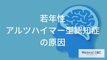 症状が出る10年前から脳内で「何」が始まっている？若年性アルツハイマーの原因と遺伝のリスク