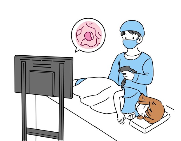 「見つけたらその場で切除」早期対応が鍵！