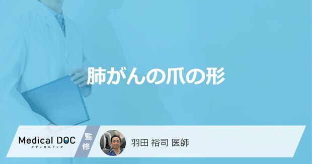 「爪の形」がどのように変化したら「肺がん」を疑った方がいい?3つの特徴を医師が解説!