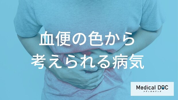 血便の色で知る「緊急度」 赤い血と黒い便を放置してはいけない理由