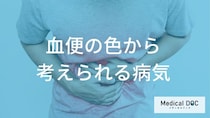 血便の色で知る「緊急度」 赤い血と黒い便を放置してはいけない理由