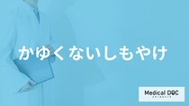 「かゆくないしもやけ」は単なる冷えではない？ 指先の変色や不調の正体を医師が解説！