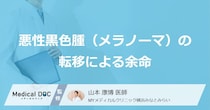「メラノーマの余命」は転移でどう変わる？”できやすい意外な場所”も医師が解説！