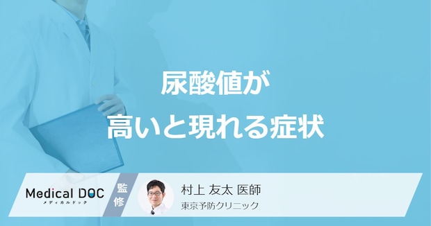 「尿酸値が高いと現れる症状」はご存知ですか？高くなりやすい人の特徴も解説！