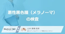 皮膚がん「メラノーマ」で”痛みのない検査”はある？３つの検査法を医師が解説！