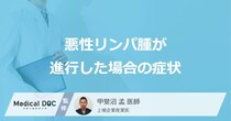 「悪性リンパ腫」が進行するとどんな症状が出るかご存知ですか？【医師解説】