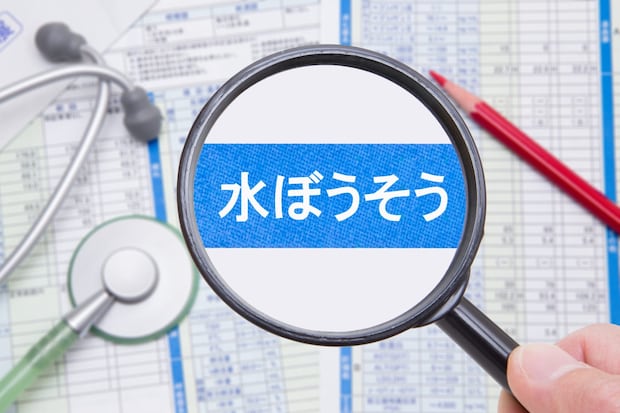 水ぼうそうの基礎知識を医師が解説！