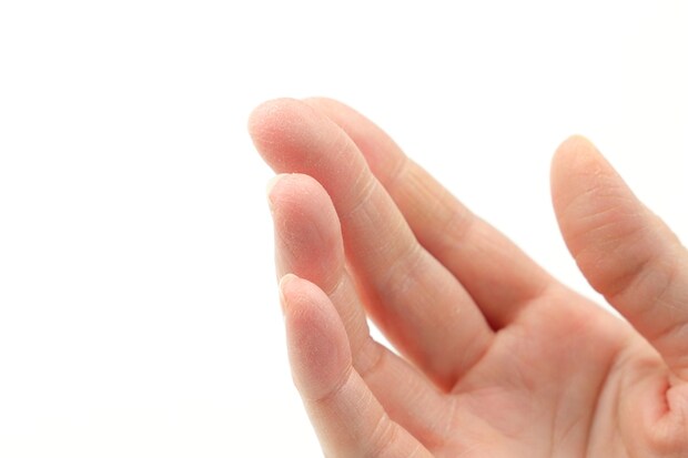 病気の発覚から不自由さを痛感