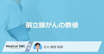 「前立腺がん」を発症すると検査でどんな「数値結果」が出るかご存知ですか？【医師解説】