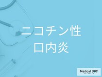 タバコを吸う人は確認を！ ニコチン性口内炎を見極める初期サインを医師が解説