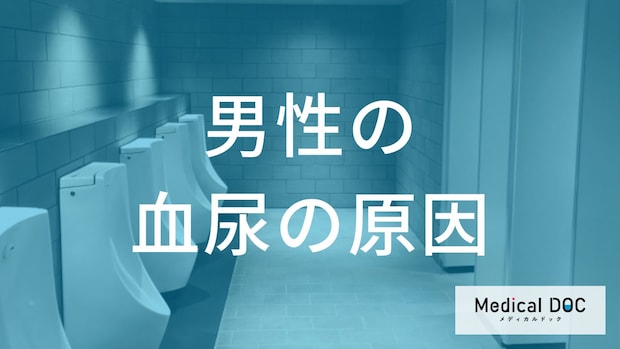 ”何色の尿”が出たら「腎がん」の前兆？男性が注意したい血尿や腰痛を解説！